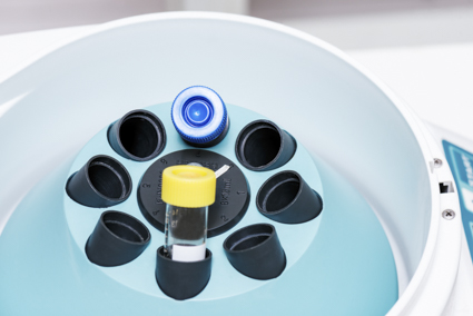 tubes  in  centrifuge for separate serum out of  blood