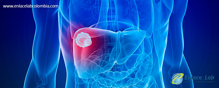 perfil-pancreas